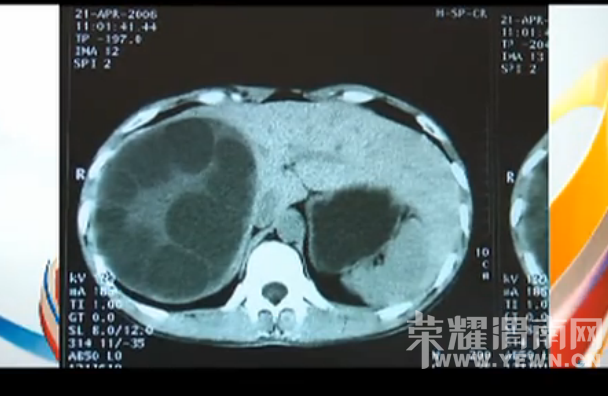 ��Ů����ȡ���Ľ��  ������Ϊ�������  ��Ҷ�������