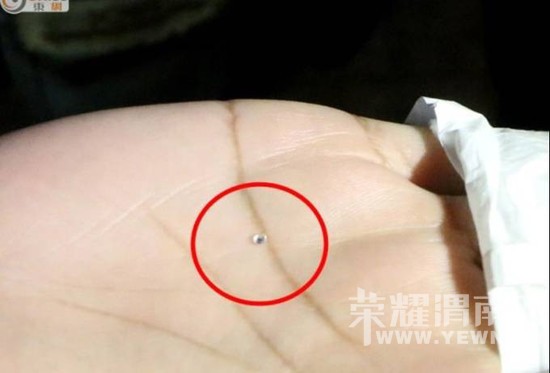 ��۽�ͷ���˺�������ʯ�� 1����ֵ����10��Ԫ