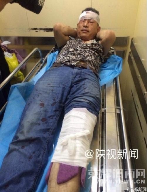 ����ը����������ԭ�����ڱ�ѹ����ը ������������ҽ