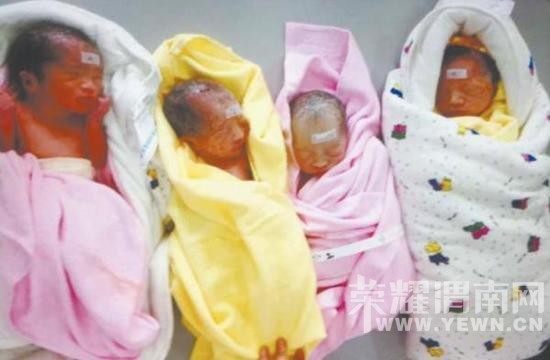 ����ϲ��ϲ����ʦ���������İ�̥ ȡ����������(ͼ)