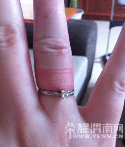 ���ϵ�Ԥ�����ˣ������ָ�׵Ľ�ָ��ȡ����������ô�죿