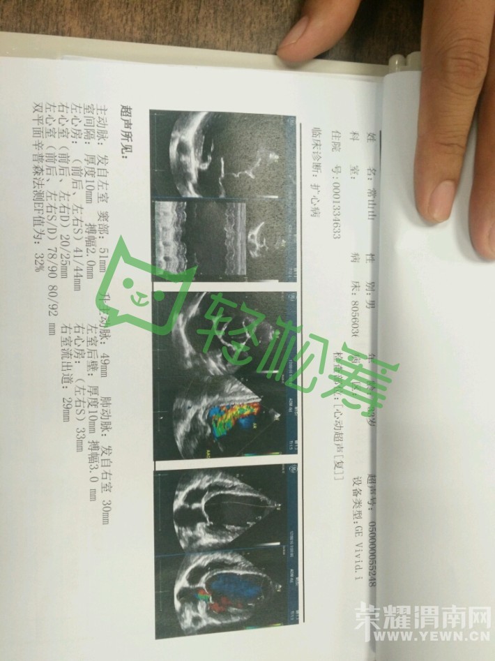 �Ⱦ��Ҹ��ɣ�