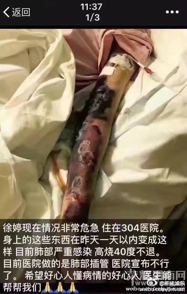 �ۻ�����װ����Ҫ��!��һ�������Ů��Ա������ȥ��