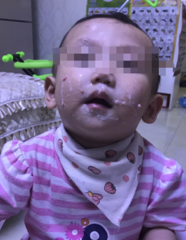 一岁半宝宝总是感冒发烧、肠胃不好、冷的甜的