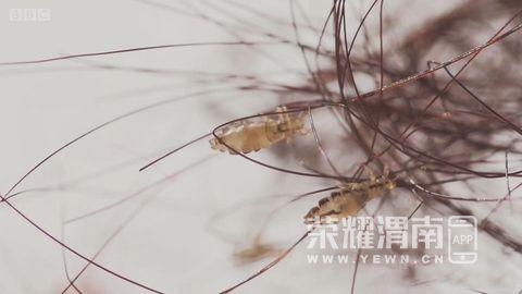 为何30年前农村几乎男女老少都有虱子,现在怎么没有了