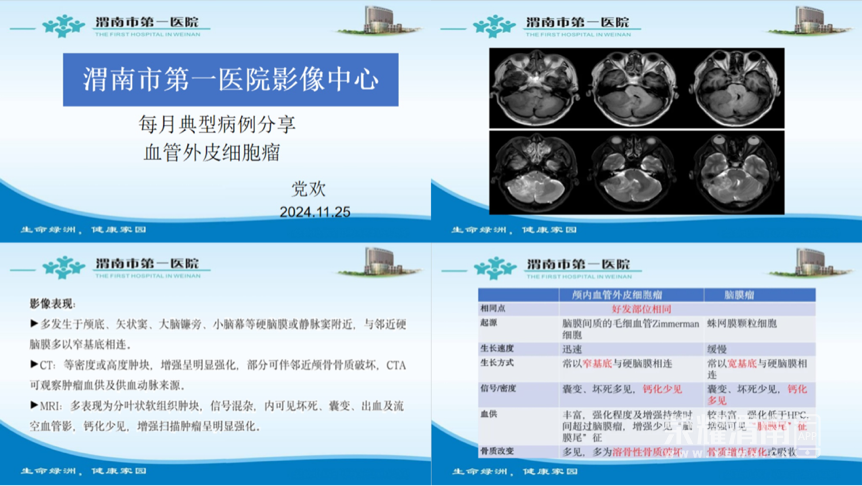 173437m4d2u5pup58fc5pf.png
