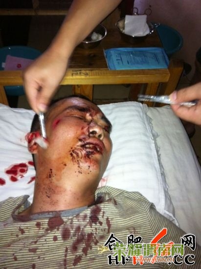 �����˵�