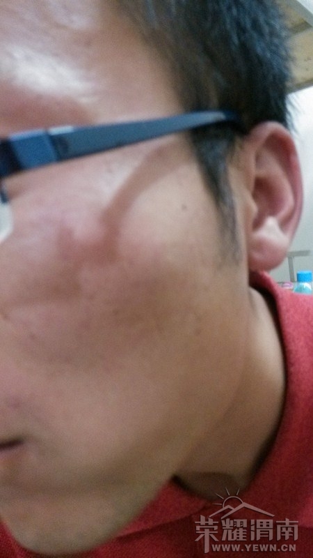 �����۾�