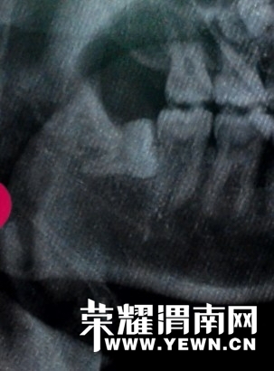 211230xdd4tde24tgt175l.jpg