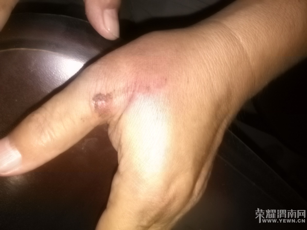 ���ϸ��׵���ޣ�