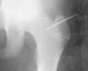 11��Ů����ͬѧ�������:��ʯͷ�������ﶤ(ͼ)