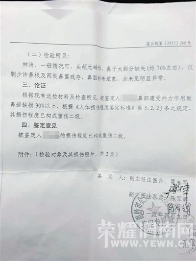 女子遭家暴被丈夫割鼻子:他说鼻子最好看(图) 女子遭家暴被丈夫割鼻子:他说鼻子最好看(图)