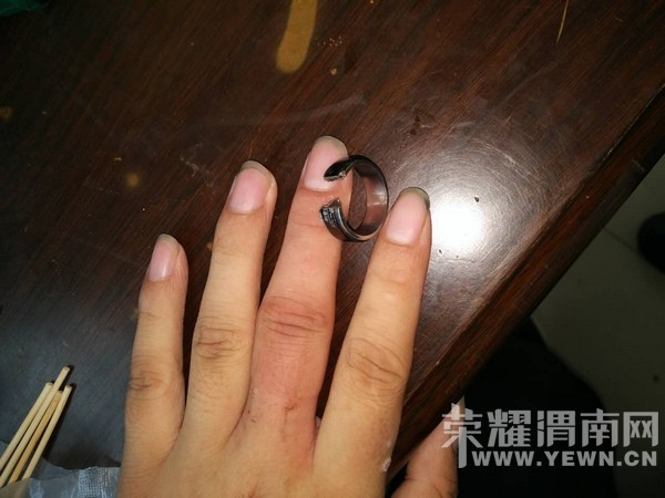 男子戒指卡手致手指肿胀 消防蜀黍出手相救
