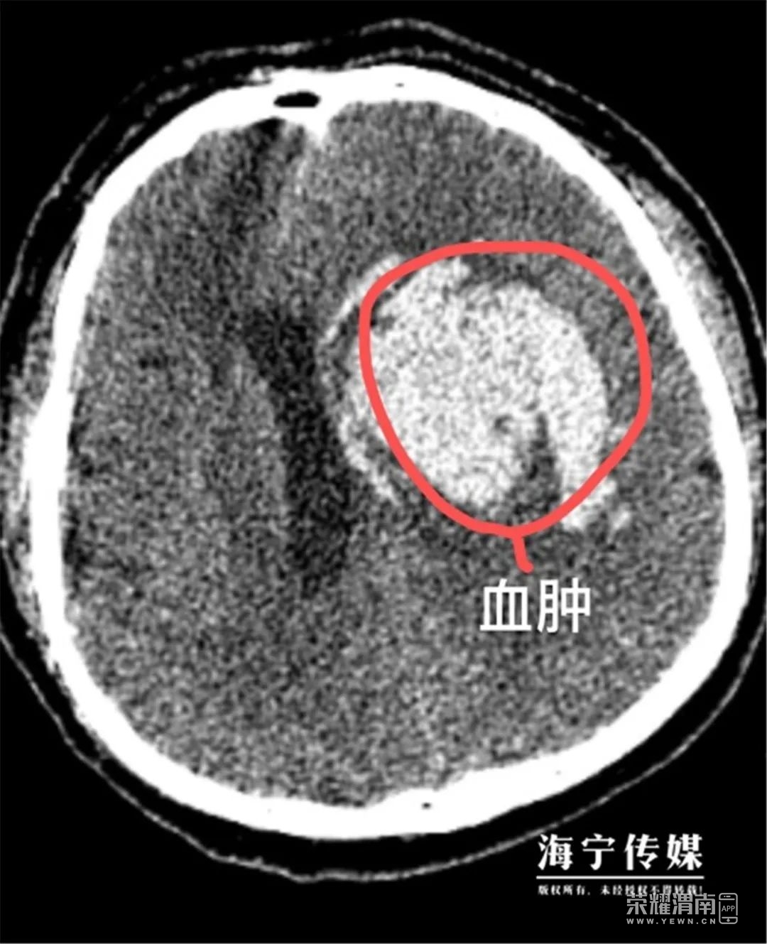 111835hczyij7ji44nzyiz.jpg