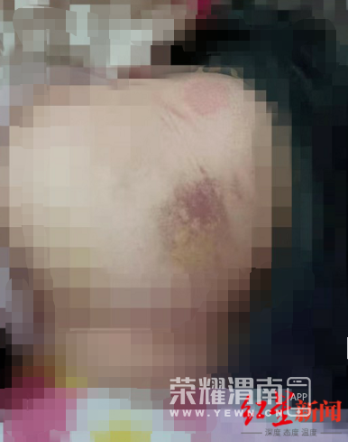 155459uj1e61lc13e1mn33.jpg