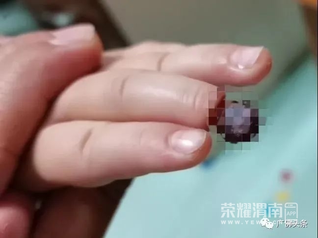 141318y6c8uhmhuc8jchfr.jpg