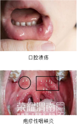 151403k445fs4i4bkr75bk.jpg