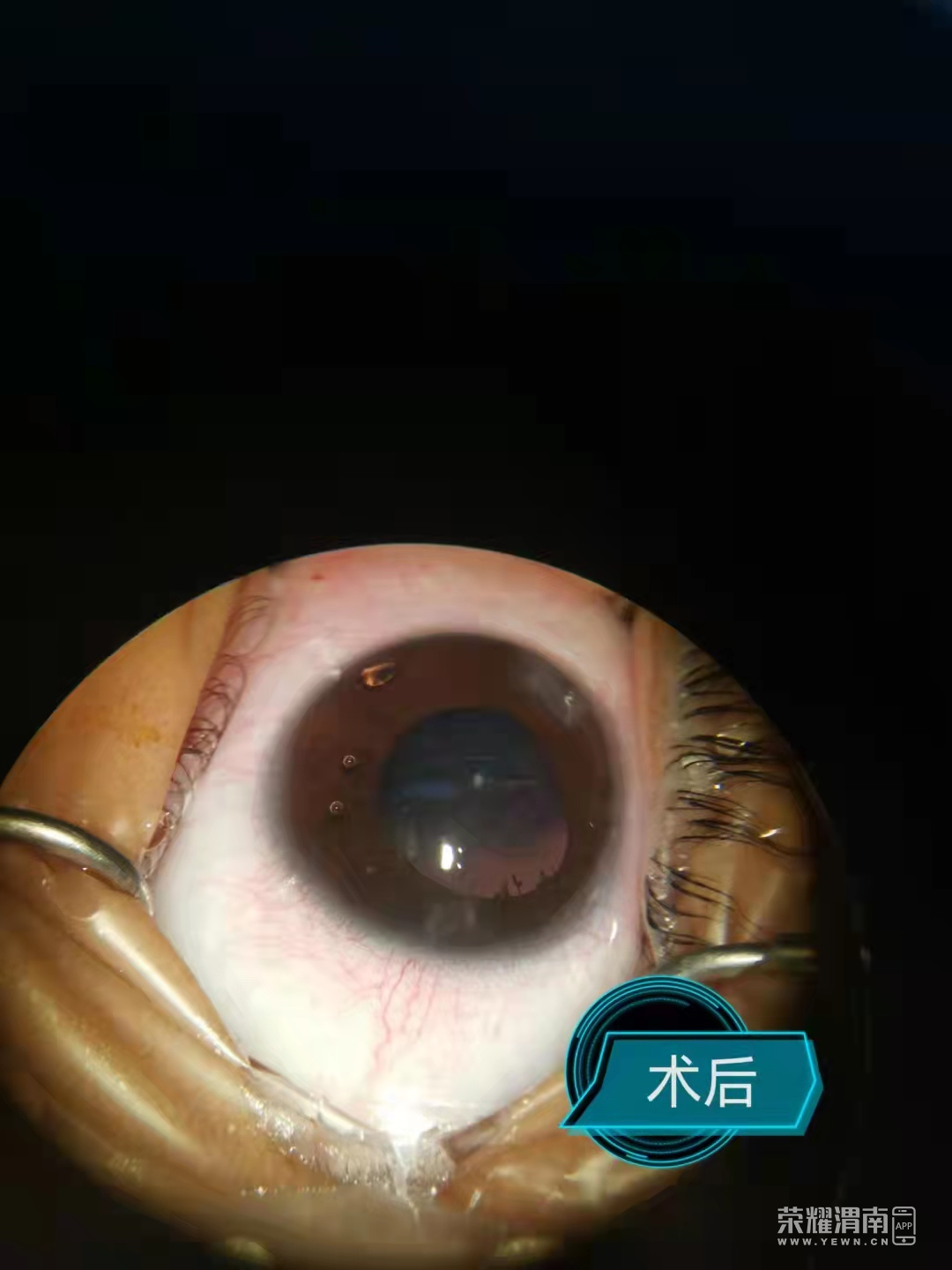 105006onv4wcm3dzdbv2vn.png