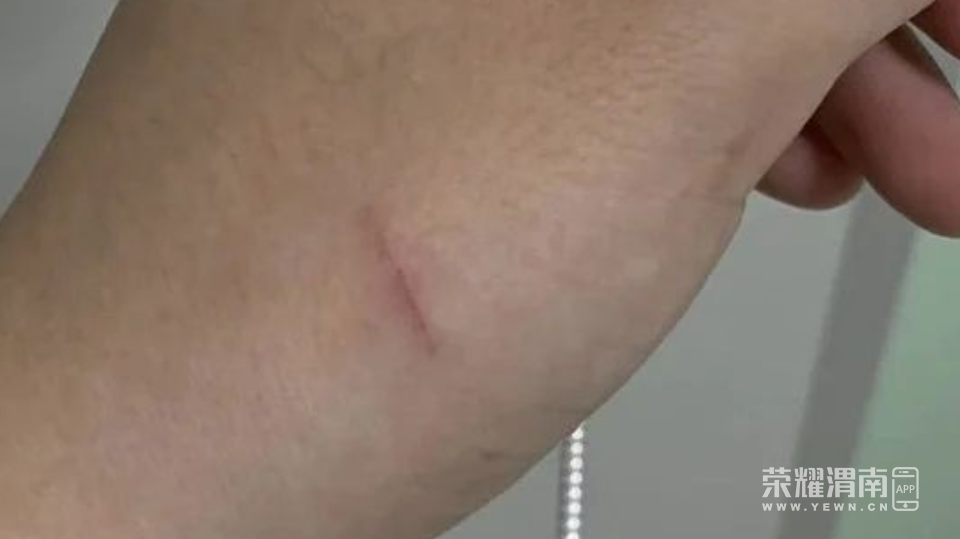 ΢Žͼ_20220913154913.png