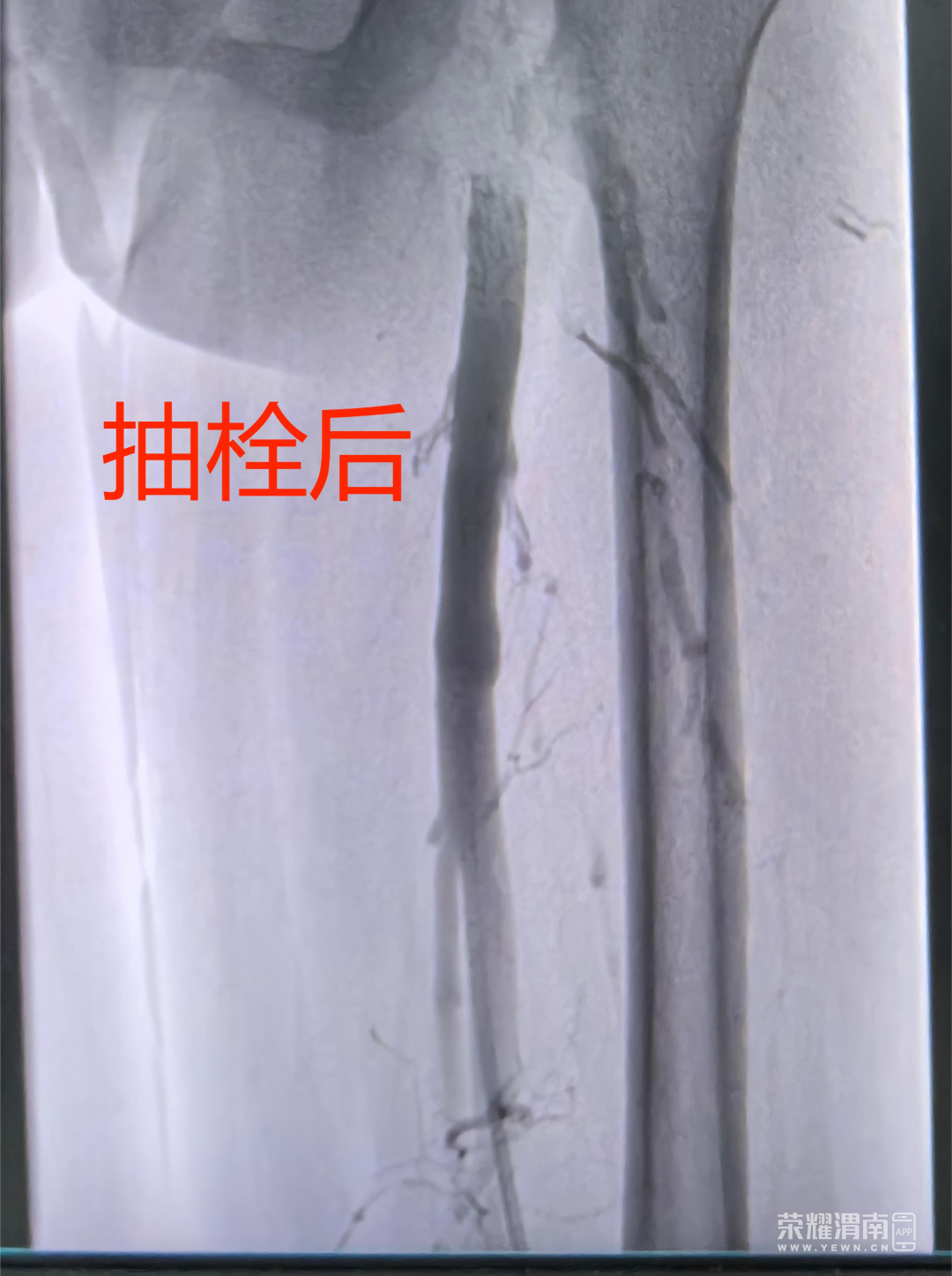 103533gu3ssgh3smzdi1cz.png
