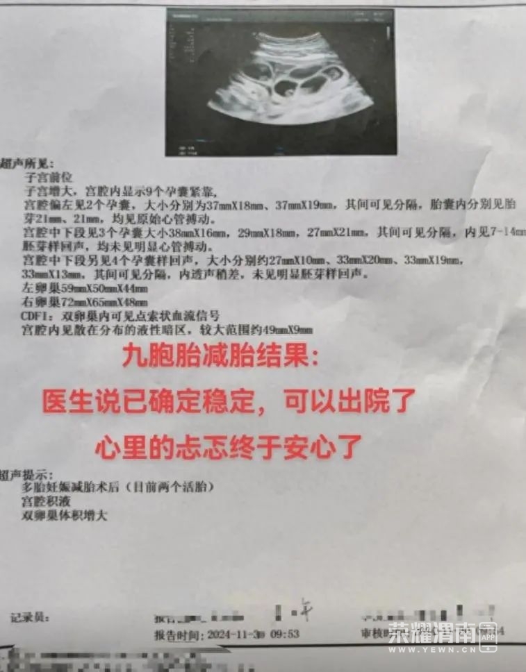 143816teeu93v3g3ugl3ul.jpeg