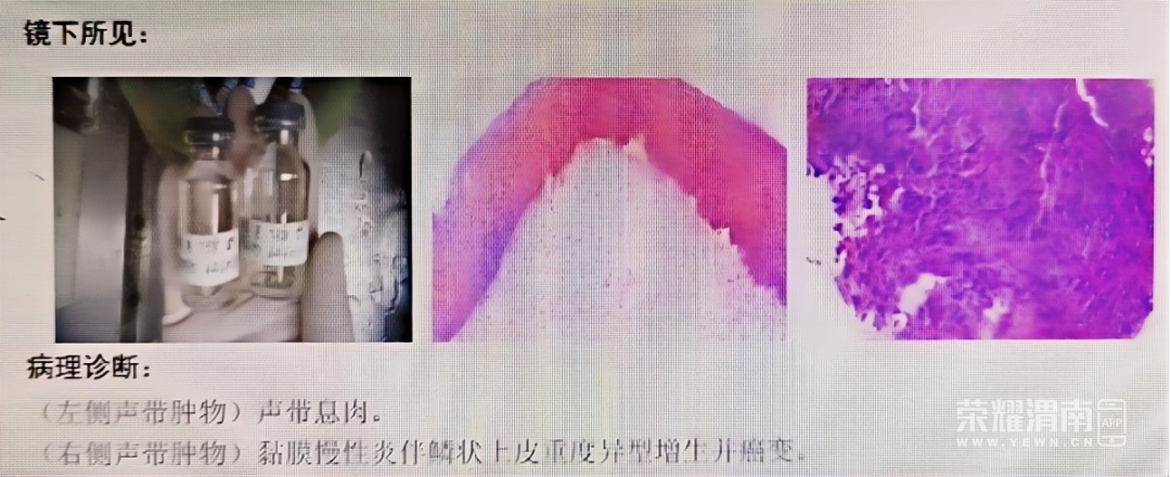 092853pu5zt5rucftczu2y.png