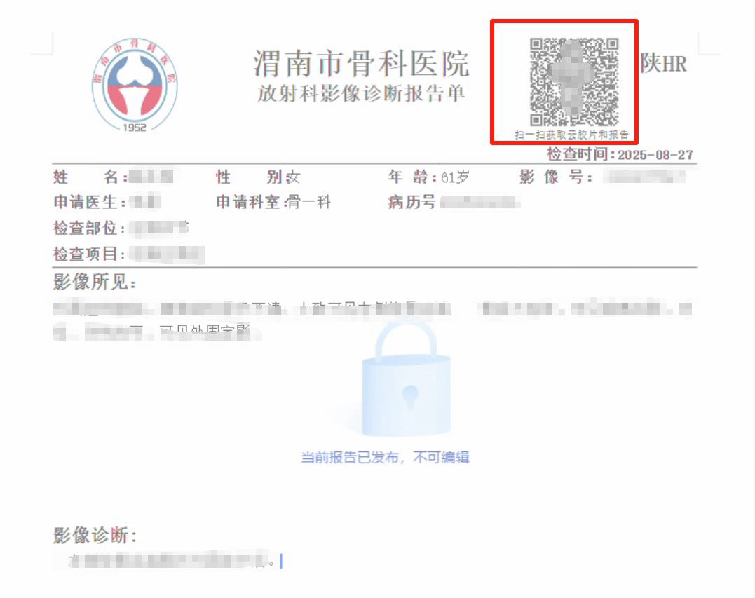 170126d8p5xsss4xj853s3.png