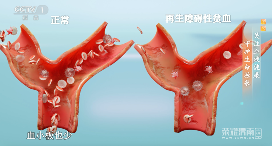 150017macl2l4e9l340as9.png